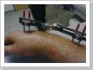 Zefixateur Zefixateur